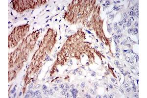 Immunohistochemistry (IHC) image for anti-Niemann-Pick Disease, Type C1 (NPC1) (AA 34-174) antibody (ABIN1724876)
