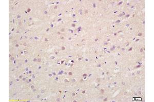 Formalin-fixed and paraffin embedded rat brain labeled with Rabbit Anti Exportin-2 Polyclonal Antibody, Unconjugated (ABIN737331) at 1:200 followed by conjugation to the secondary antibody and DAB staining (Exportin 2 Antikörper  (AA 901-971))