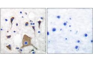 Immunohistochemistry (IHC) image for anti-Glutamate Receptor, Ionotropic, Kainate 1 (GRIK1) (AA 10-59) antibody (ABIN2889205) (GRIK1 Antikörper  (AA 10-59))