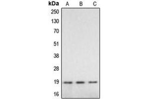 Western blot analysis of Caspase 2 p18 expression in HeLa (A), mouse liver (B), rat liver (C) whole cell lysates. (Caspase 2 p18 Antikörper  (Center))