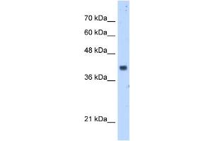 PDSS1 antibody used at 5 ug/ml to detect target protein. (PDSS1 Antikörper)