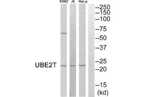 Western Blotting (WB) image for anti-Ubiquitin-Conjugating Enzyme E2T (Ube2t) (Internal Region) antibody (ABIN1852362) (Ube2t Antikörper  (Internal Region))