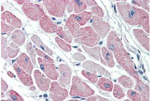 Human Heart (formalin-fixed, paraffin-embedded) stained with CLIC4 antibody ABIN337111 at 5 ug/ml followed by biotinylated anti-goat IgG secondary antibody ABIN481715, alkaline phosphatase-streptavidin and chromogen. (CLIC4 Antikörper  (AA 8-20))