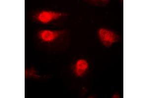 Immunofluorescent analysis of p27 Kip1 (pT187) staining in A431 cells. (CDKN1B Antikörper  (C-Term, pSer187))