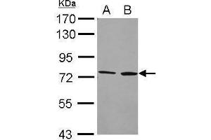 WB Image Sample (20 ug) A: Hela whole cell lysate B: Hela cell membrane 7.