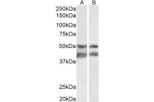 Image no. 1 for anti-E2F Transcription Factor 4, P107/p130-Binding (E2F4) antibody (ABIN5900178) (E2F4 Antikörper)