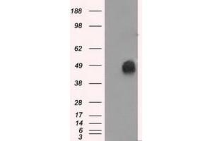 HEK293T cells were transfected with the pCMV6-ENTRY control (Left lane) or pCMV6-ENTRY ERCC1 (Right lane) cDNA for 48 hrs and lysed. (ERCC1 Antikörper)