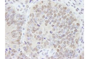 Immunohistochemistry (IHC) image for anti-A Kinase (PRKA) Anchor Protein 8 (AKAP8) (C-Term) antibody (ABIN7448405) (AKAP8 Antikörper  (C-Term))