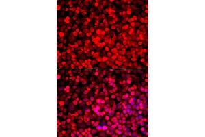 Immunofluorescence analysis of HeLa cells using PUF60 antibody. (PUF60 Antikörper  (AA 243-542))