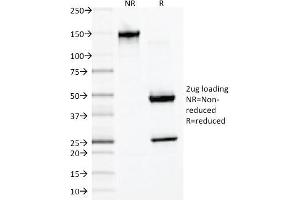 SDS-PAGE Analysis of Purified Desmin Monoclonal Antibody (DES/1711). (Desmin Antikörper)