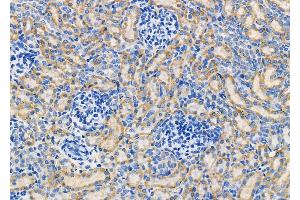 ABIN6261181 and ABIN6278835 at 1/100 staining Rat kidney tissue by IHC-P.