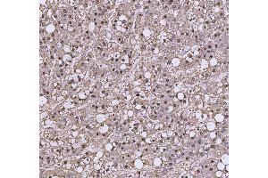 IHC analysis of TRIR using anti-TRIR antibody (ABIN7603244). (Uncharacterized Protein C19orf43 (TRIR) (N-Term) Antikörper)