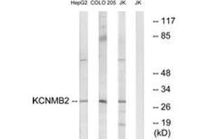 Western blot analysis of extracts from Jurkat/COLO/HepG2 cells, using KCNMB2 Antibody. (KCNMB2 Antikörper  (AA 151-200))