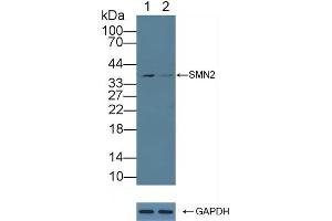 Western Blotting (WB) image for anti-serpin Peptidase Inhibitor, Clade B (Ovalbumin), Member 9 (SERPINB9) (AA 1-376) antibody (ABIN7435502)