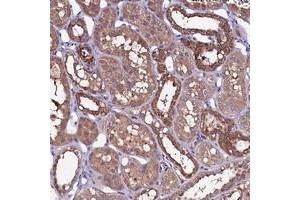 Immunohistochemical staining of human kidney with NARFL polyclonal antibody  shows strong cytoplasmic positivity in distal tubules at 1:200-1:500 dilution. (NARFL Antikörper)