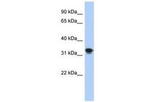 Image no. 1 for anti-Centromere Protein P (CENPP) (AA 35-84) antibody (ABIN6741259) (CENPP Antikörper  (AA 35-84))