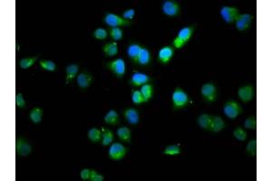 Immunofluorescence staining of Hela cells with ABIN7165976 at 1:100, counter-stained with DAPI. (SSH1 Antikörper  (AA 928-1049))