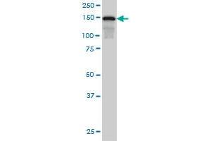 SAFB monoclonal antibody (M04), clone 5A11 Western Blot analysis of SAFB expression in Hela S3 NE . (SAFB Antikörper  (AA 111-200))