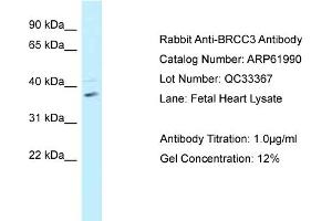 Western Blotting (WB) image for anti-BRCA1/BRCA2-Containing Complex, Subunit 3 (BRCC3) (C-Term) antibody (ABIN2788976) (BRCC3 Antikörper  (C-Term))