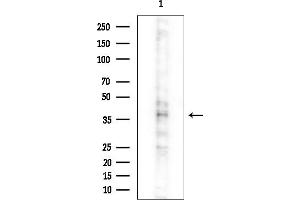 anti-RELT Tumor Necrosis Factor Receptor (RELT) (C-Term) antibody