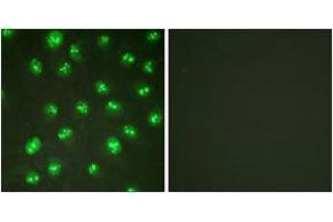 Immunofluorescence analysis of HuvEc cells, using p57 Kip2 (Ab-310) Antibody. (CDKN1C Antikörper  (AA 267-316))
