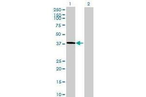 Lane 1: C5orf36 transfected lysate ( 37.