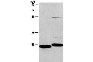 Western Blot analysis of Mouse intestinum tenue and heart tissue using CIDEC Polyclonal Antibody at dilution of 1:551 (CIDEC Antikörper)