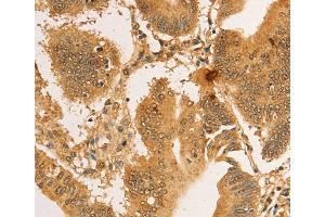 Immunohistochemistry (IHC) image for anti-Ribosomal Protein L26-Like 1 (RPL26L1) antibody (ABIN2422743) (RPL26L1 Antikörper)