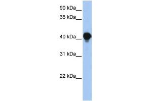 WB Suggested Anti-PTPLAD1 Antibody Titration:  0. (PTPLAD1 Antikörper  (N-Term))