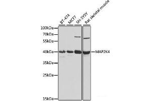 Western blot analysis of extracts of various cell lines using MAP2K4 Polyclonal Antibody at dilution of 1:1000. (MAP2K4 Antikörper)