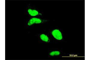 Immunofluorescence of monoclonal antibody to AATF on HeLa cell. (AATF Antikörper  (AA 151-250))