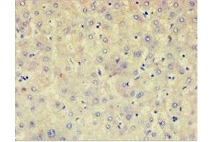 Immunohistochemistry of paraffin-embedded human liver tissue using ABIN7143031 at dilution of 1: 100 (AFAP Antikörper  (AA 461-730))