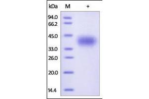 Human CD200, His Tag on SDS-PAGE under reducing (R) condition. (CD200 Protein (CD200) (AA 31-232) (His tag))
