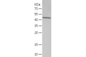 Western Blotting (WB) image for RAB27A, Member RAS Oncogene Family (RAB27A) (AA 1-221) protein (His-IF2DI Tag) (ABIN7124745)