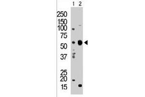 The PACSIN2 polyclonal antibody  is used in Western blot to detect PACSIN2 in T-47D cell lysate (Lane 1) and mouse brain tissue lysate (Lane 2) . (PACSIN2 Antikörper  (C-Term))