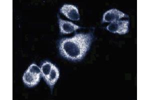Immunofluorescence of AN3 CA cells (Human endometrial adenocarcinoma, ATCC HTB-111). (Sec8 Antikörper  (AA 31-201))