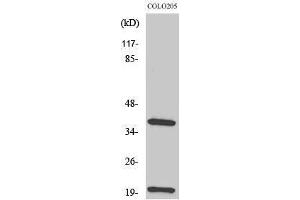 TCR beta Antikörper  (Internal Region)