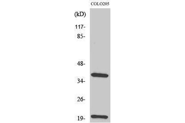 TCR beta Antikörper  (Internal Region)