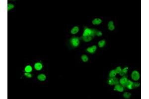 Image no. 17 for anti-Replication Protein A2, 32kDa (RPA2) antibody (ABIN1500733)