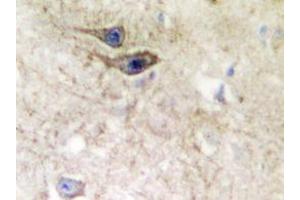 Immunohistochemistry analyzes of EphB1/2 antibody in paraffin-embedded human brain tissue. (EPH Receptor B1 Antikörper)