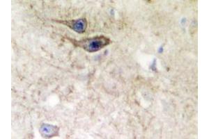 Immunohistochemistry analyzes of EphB1/2 antibody in paraffin-embedded human brain tissue.