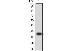 Western blot analysis using MSLN mAb against human MSLN (AA: 296-606) recombinant protein.
