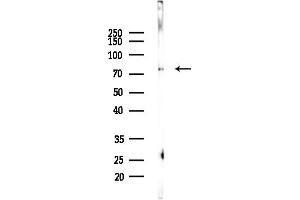 anti-Epithelial Splicing Regulatory Protein 2 (ESRP2) (N-Term) antibody