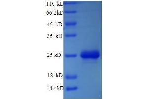 SDS-PAGE (SDS) image for Apolipoprotein C-III (APOC3) (AA 21-99) protein (His-SUMO Tag) (ABIN5709067) (APOC3 Protein (AA 21-99) (His-SUMO Tag))