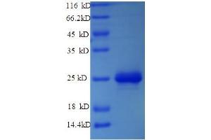 SDS-PAGE (SDS) image for Apolipoprotein C-III (APOC3) (AA 21-99) protein (His-SUMO Tag) (ABIN5709067)