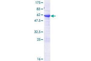 BCL7B Protein (AA 1-202) (GST tag)