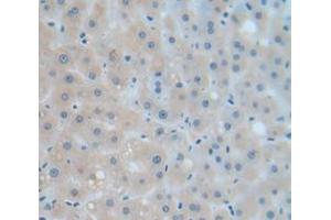 IHC-P analysis of Human Tissue, with DAB staining. (Complement Factor B Antikörper  (AA 477-600))