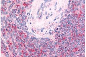 Human Spleen, Central Artery and Lymphocytes Within Periarteriolar Lymphoid Sheaths (formalin-fixed, paraffin-embedded) stained with c-Kit antibody ABIN213610 at 20 ug/ml followed by biotinylated goat anti-rabbit IgG secondary antibody ABIN481713, alkaline  . (KIT Antikörper  (Extracellular Domain))