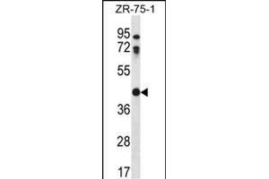 CTSO Antibody (N-term) (ABIN656692 and ABIN2845928) western blot analysis in ZR-75-1 cell line lysates (35 μg/lane).