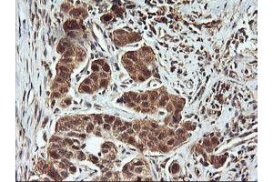 Image no. 3 for anti-F-Box Protein 21 (FBXO21) antibody (ABIN1498234)